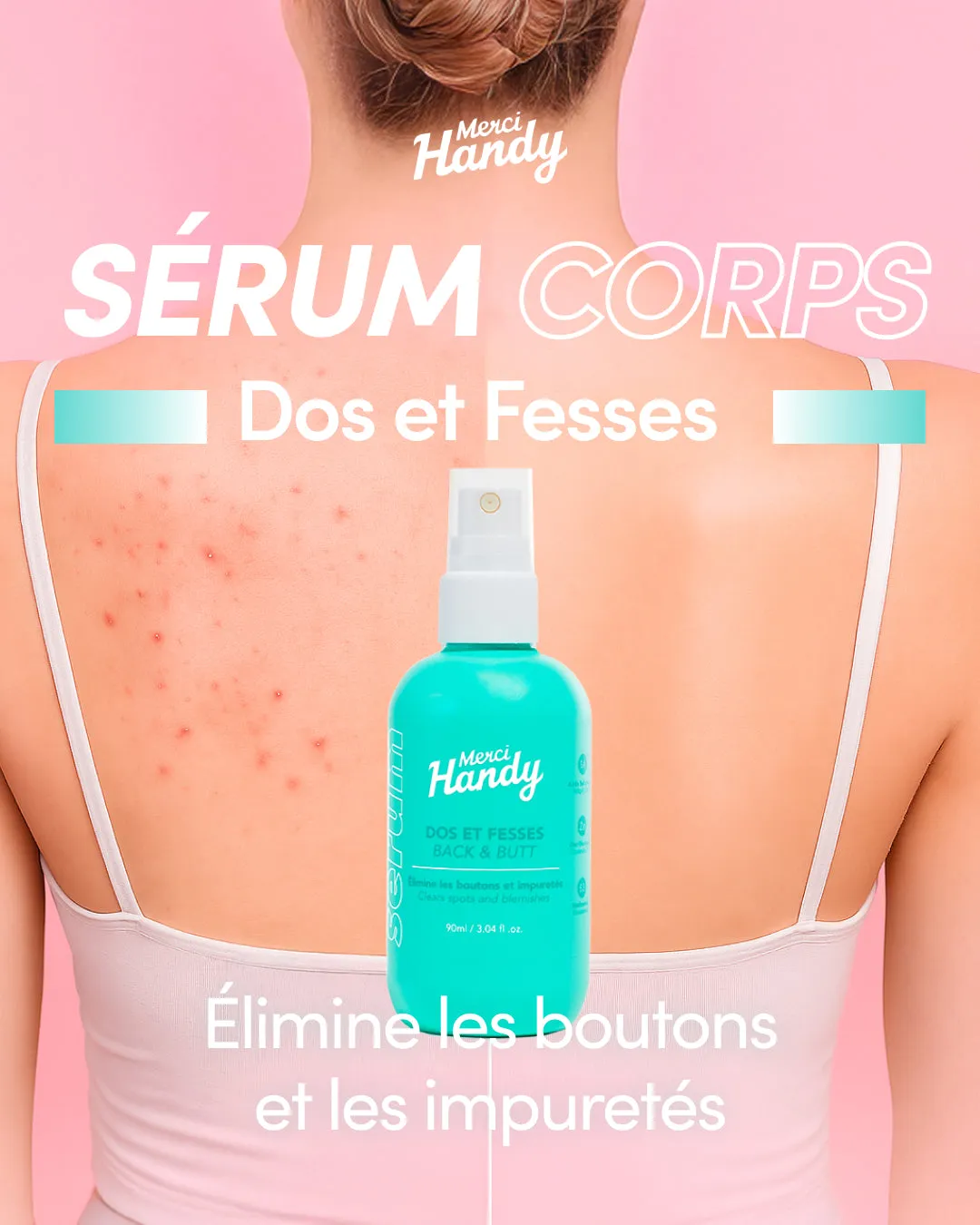 Merci Handy Dos & Fesses Körperserum gegen Pickel